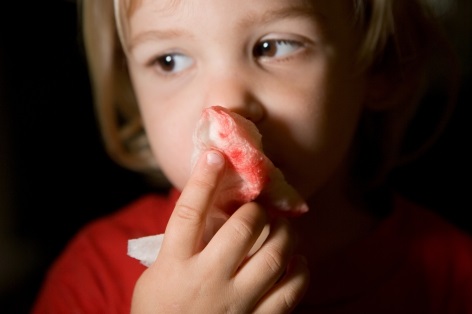 Кровь из носа у ребенка: причины, симптомы и меры неотложной помощи